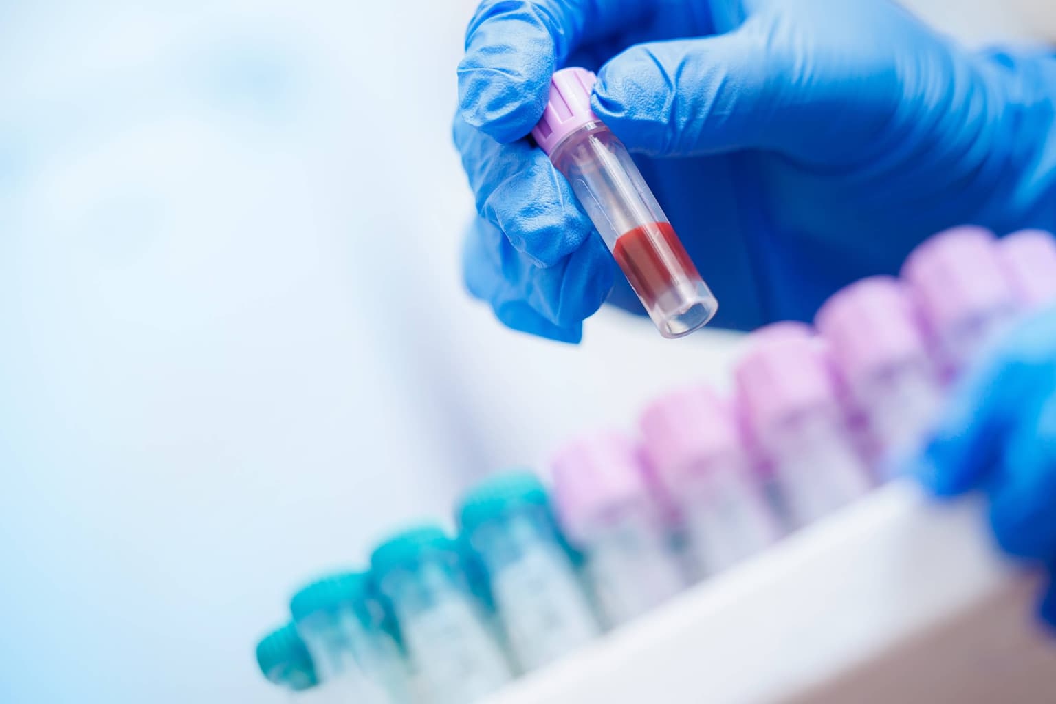 Analize pentru monitorizarea inflamației: de ce sunt importante?