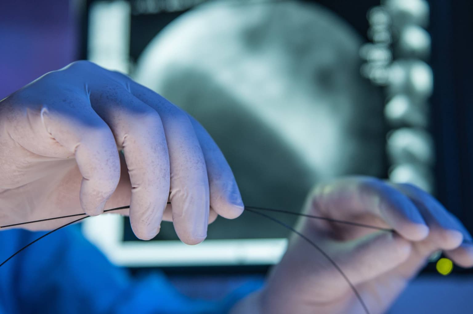 Anevrismul de aorta: cauze, simptome, tratament