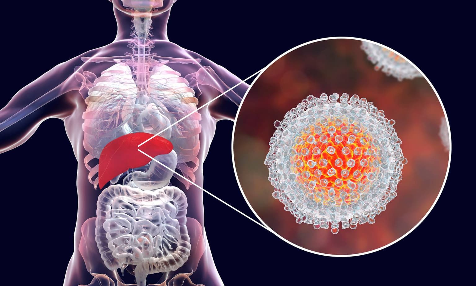Hepatita C, afecțiunea care se transmite prin sânge