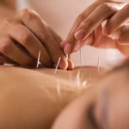 Cum ne poate ajuta acupunctura?