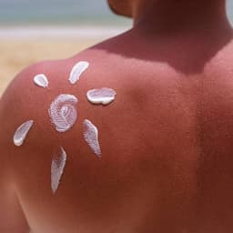 Tot ce trebuie să știi despre arsurile solare: simptome, tratament și prevenție