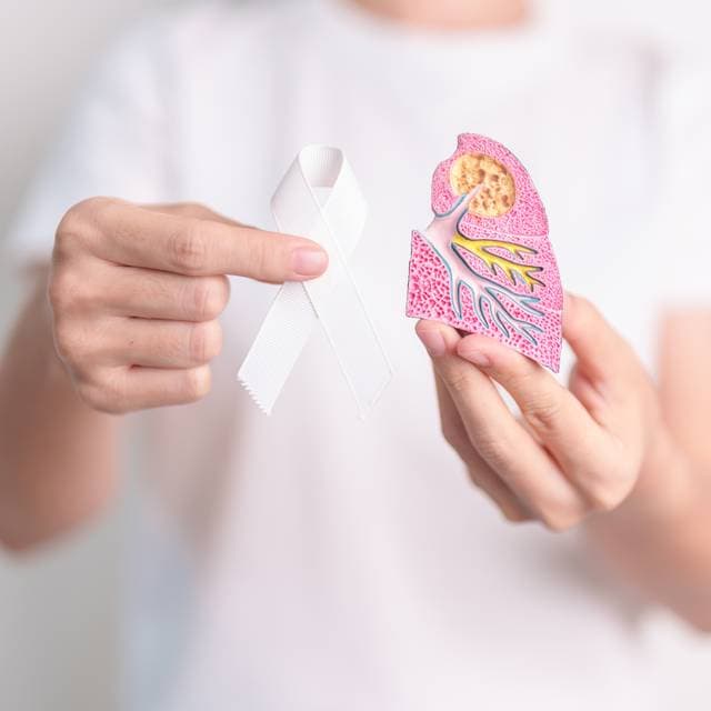 Cancer pulmonar: informații esențiale și recomandări practice pentru pacienți