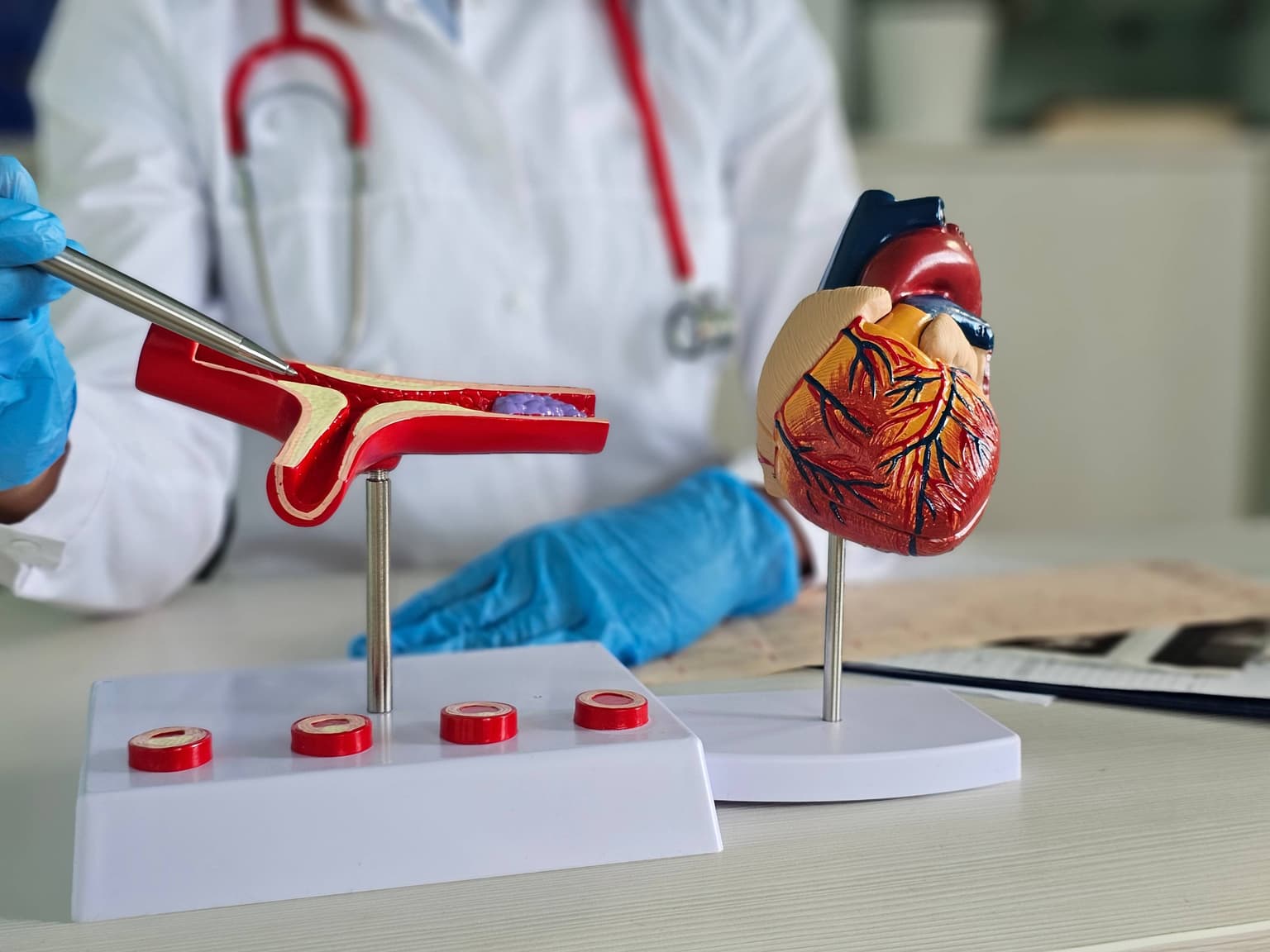 Tromboza: cauze, simptome, diagnostic, tratament