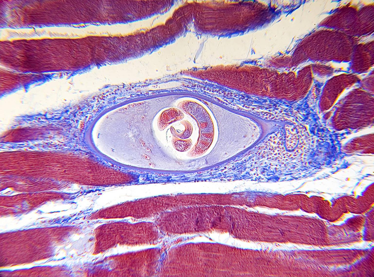 Trichinella spiralis - generalități, analize medicale recomandate