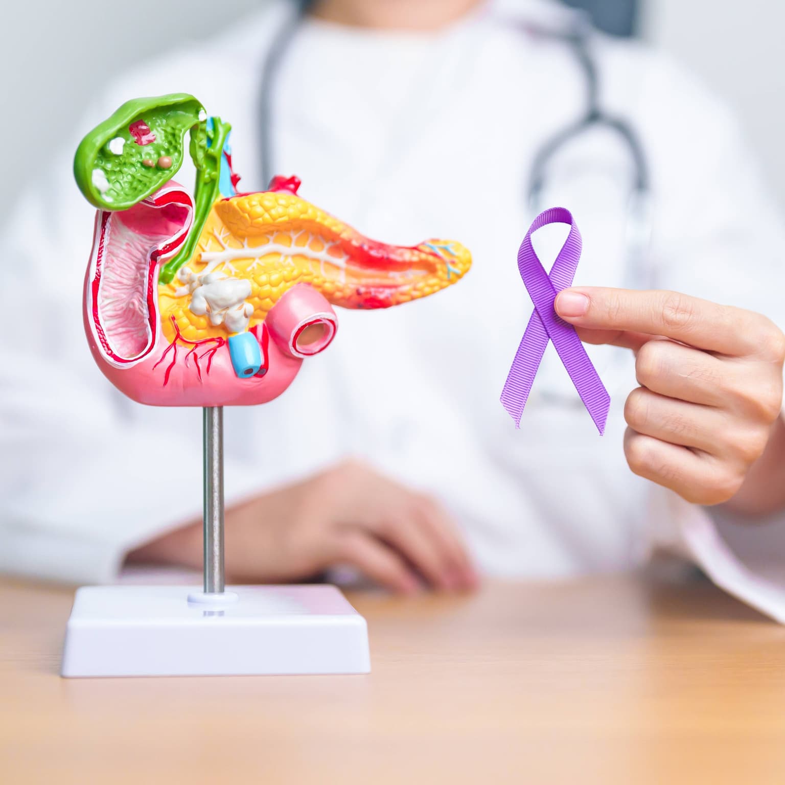 Cancerul de pancreas: cauze, tipuri, simptome, tratament