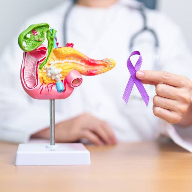 Cancerul de pancreas: cauze, tipuri, simptome, tratament